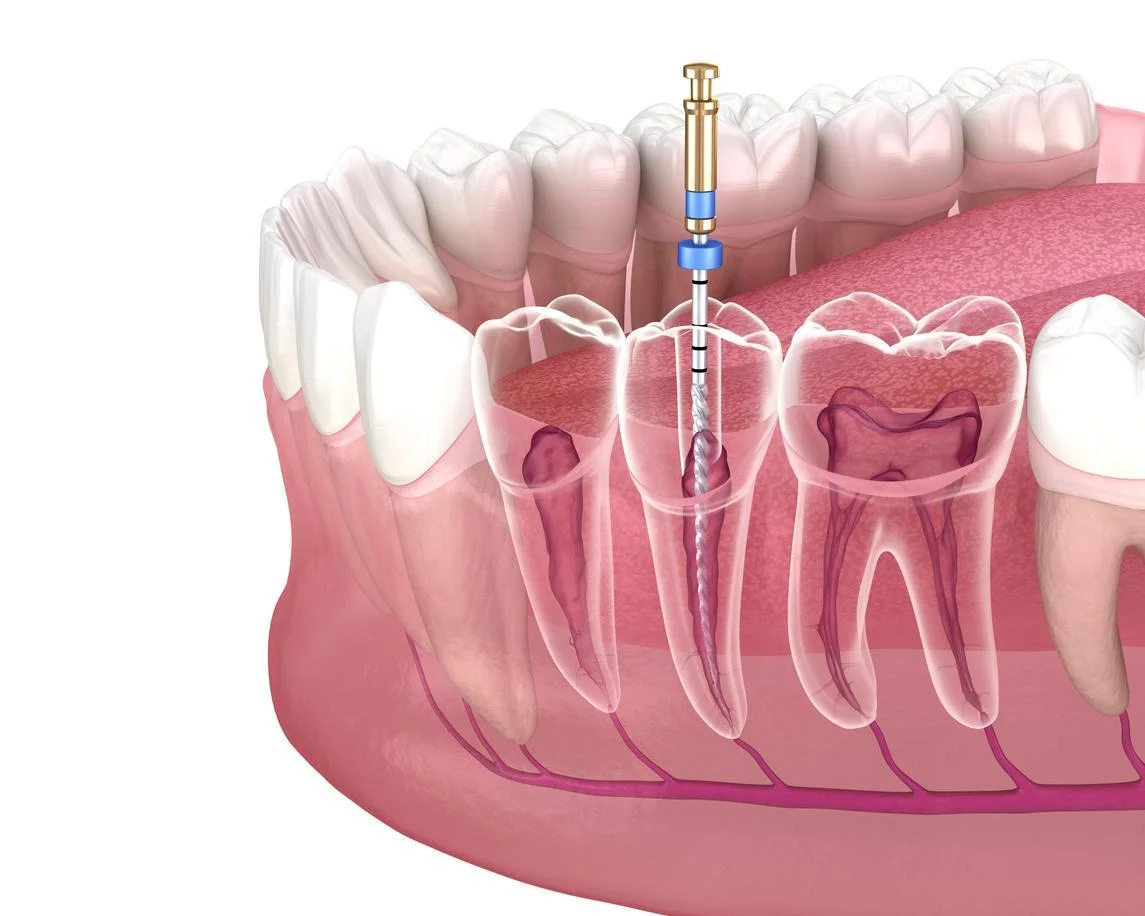 Endodontics